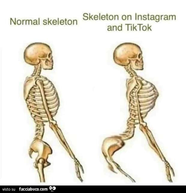 Normal skeleton. Skeleton on instagram and tiktok