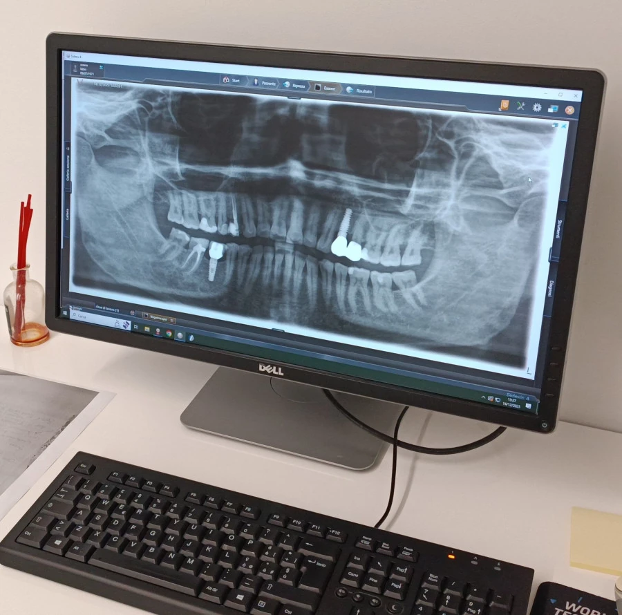 Radiografia Dentaria